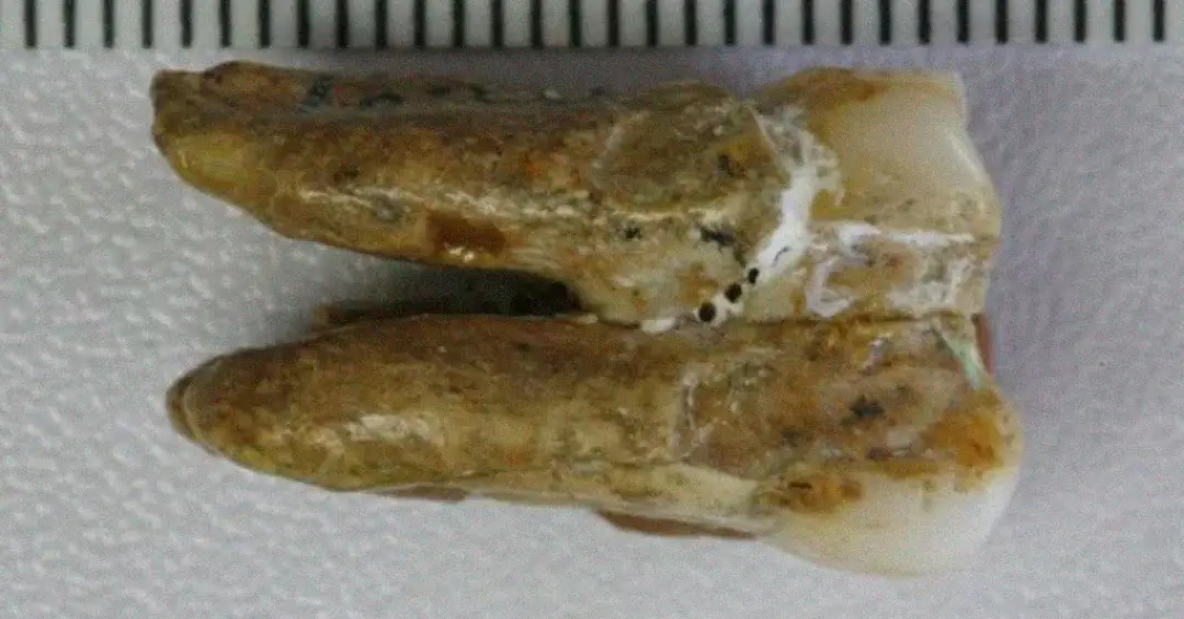Dentes de 400 mil anos apontam cruzamento entre denisovanos e Homo erectus