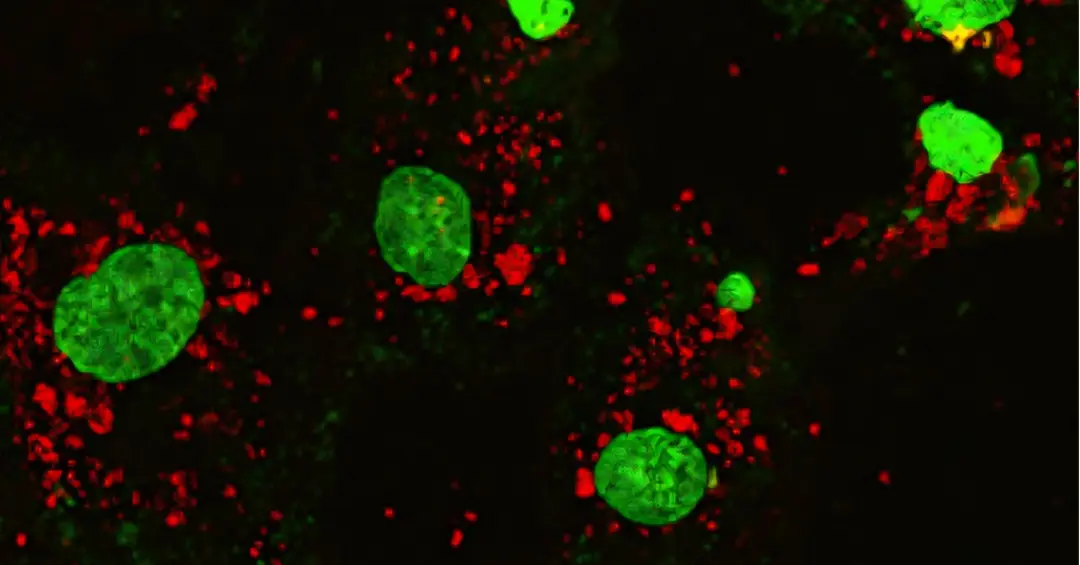 Nanopartículas de grafeno podem transportar remédios até tumores de câncer de mama