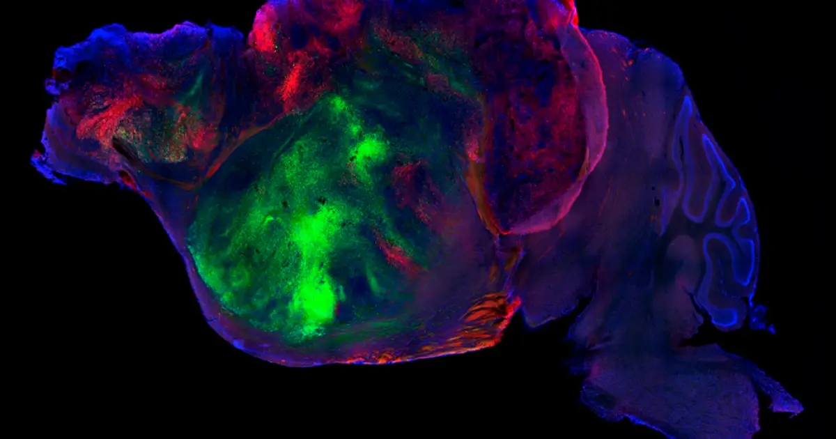 Cientistas criam camundongos que têm células cerebrais humanas